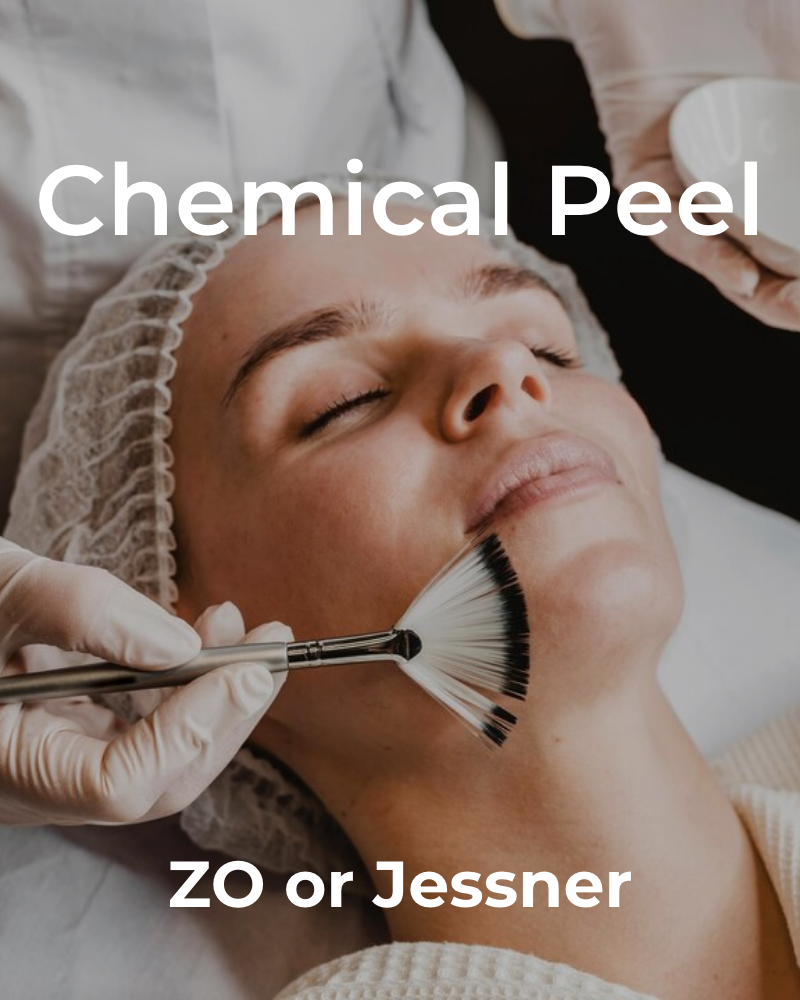 Service Voucher - ZO® Stimulator or Jessner Chemical Peel