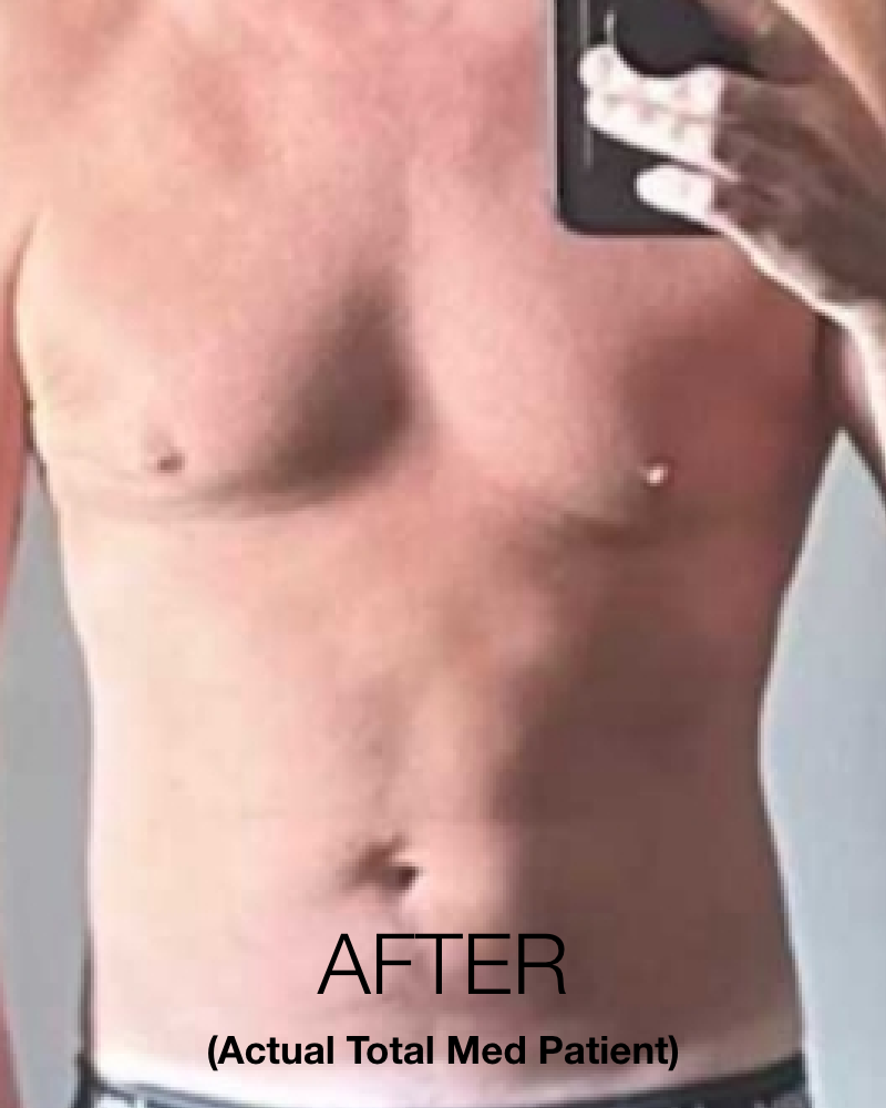 Service Voucher - Tirzepatide GLP-1, GIP 8-Week Program + 3 FREE Fat Burner Shots