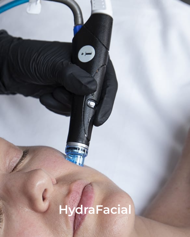 One (1) Signature HydraFacial - Full Face & Neck