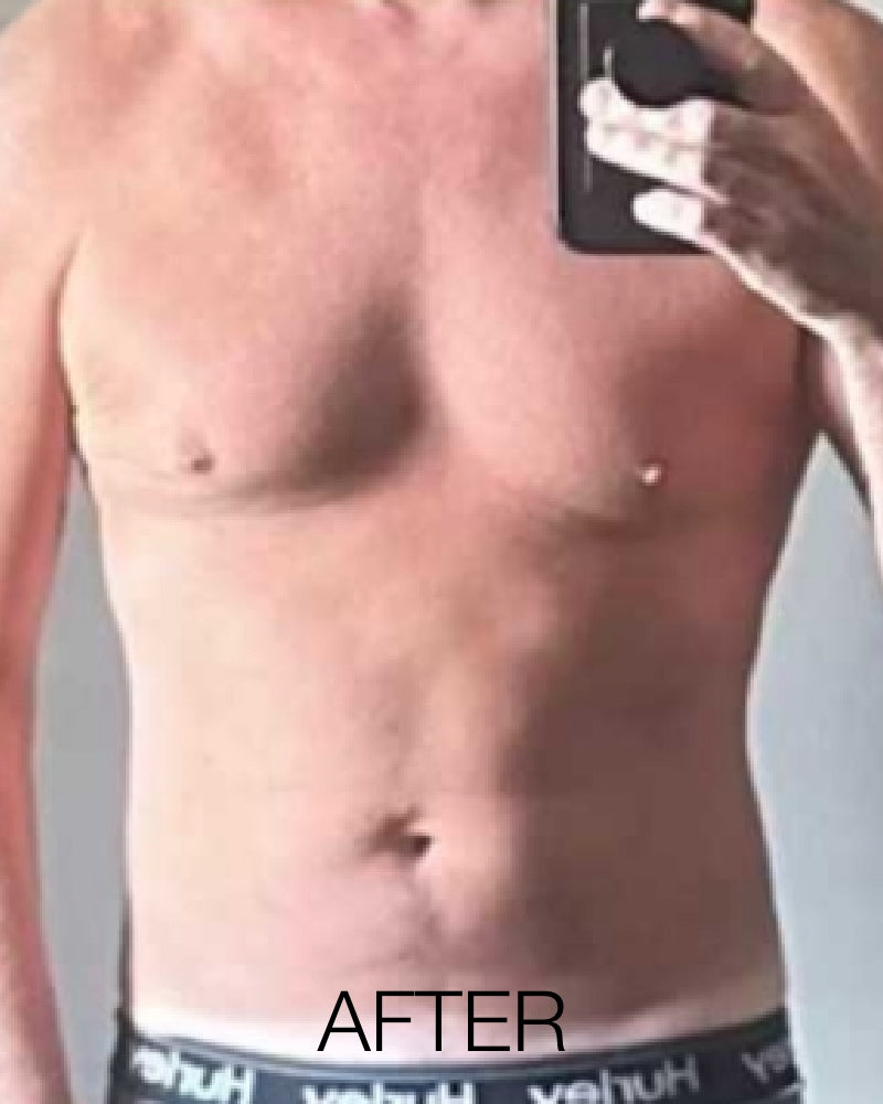 Service Voucher - Tirzepatide GLP-1, GIP 8-Week Program + FREE $50 Total Med Gift Card