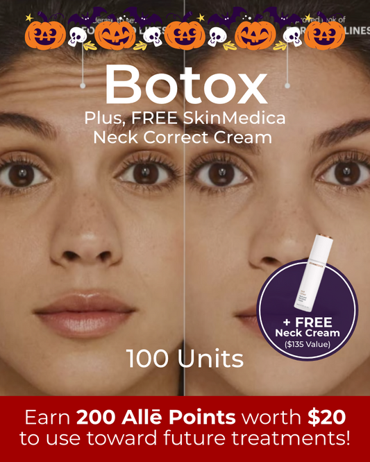 Service Voucher - Botox 100 Units + FREE SkinMedica Neck Correct Cream (50ml - $135 Value)