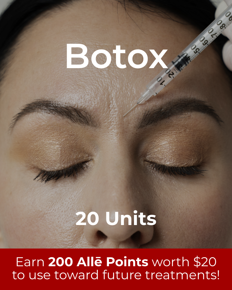 Service Voucher - Botox 20 Units