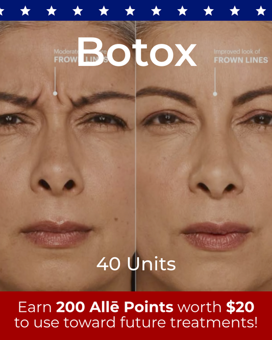 Service Voucher - Botox 40 Units