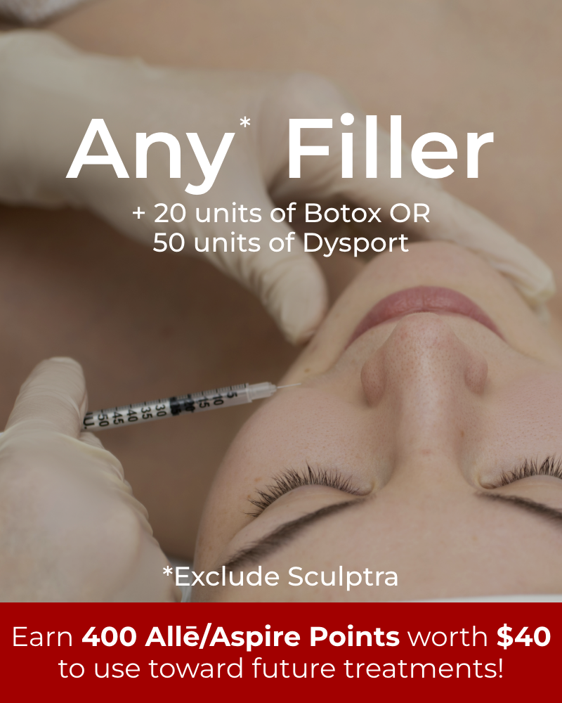 Service Voucher – Any Filler of Your Choice + FREE 20 Units of Botox or 50 Units of Dysport