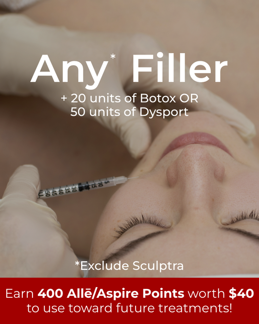 Service Voucher – Any Filler of Your Choice + 20 Units of Botox or 50 Units of Dysport