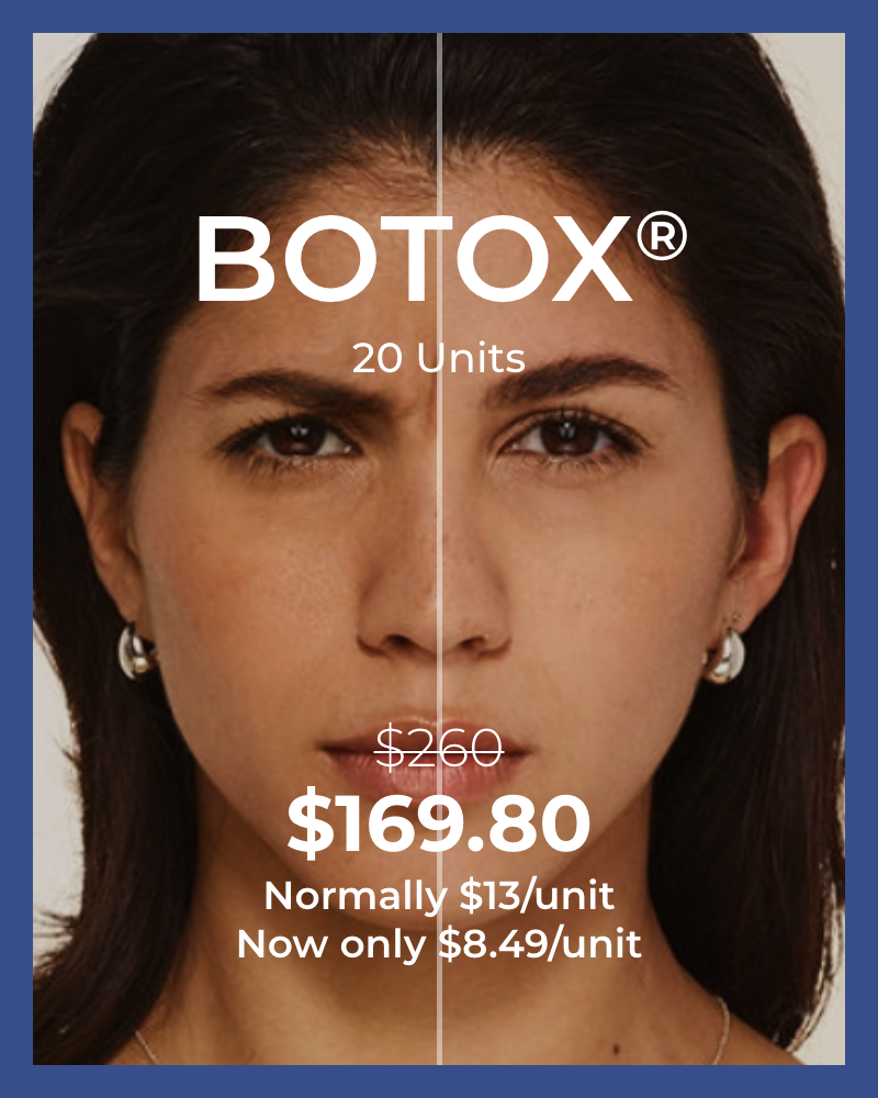 20 units of Botox for $8.49/unit (New Patients Only)