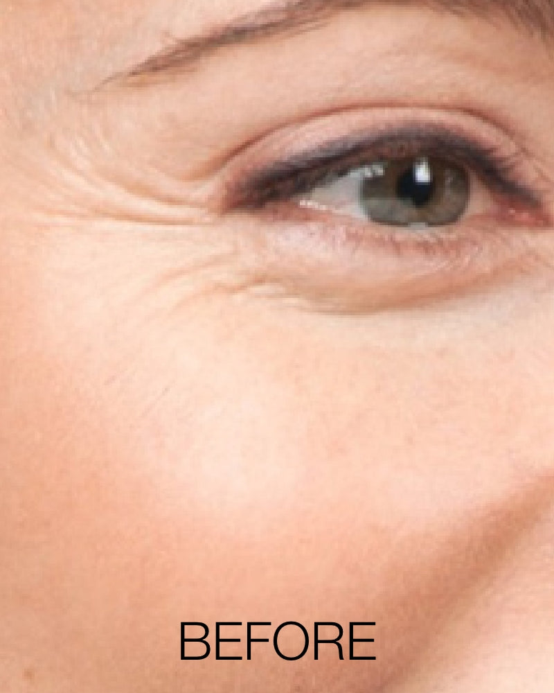 Service Voucher - Botox 20 Units
