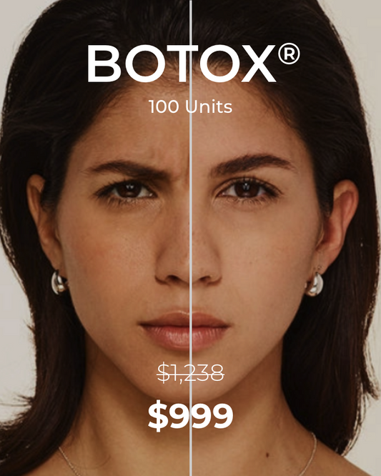 Service Voucher - Botox 100 Units