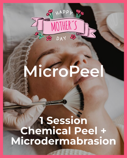 One (1) Micro Peel: Chemical Peel of Your Choice + Microdermabrasion Combo