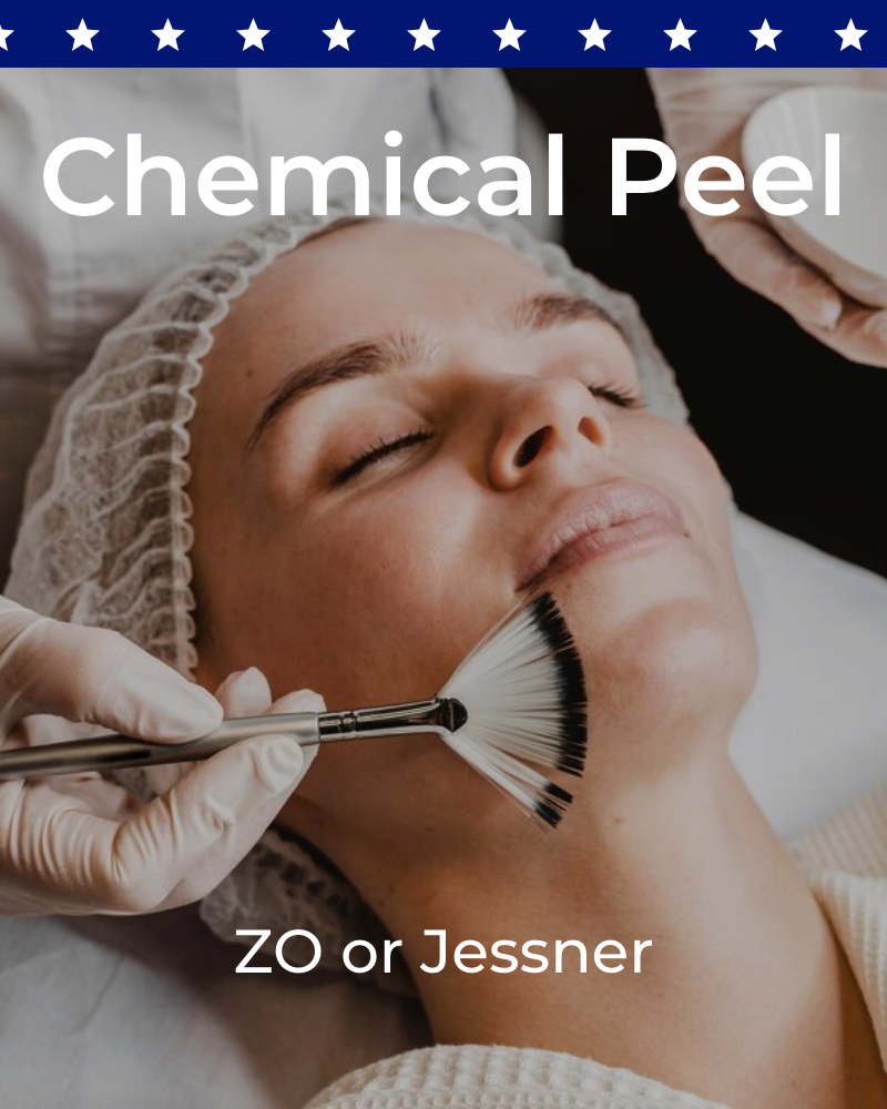 ZO® Stimulator or Jessner Chemical Peel