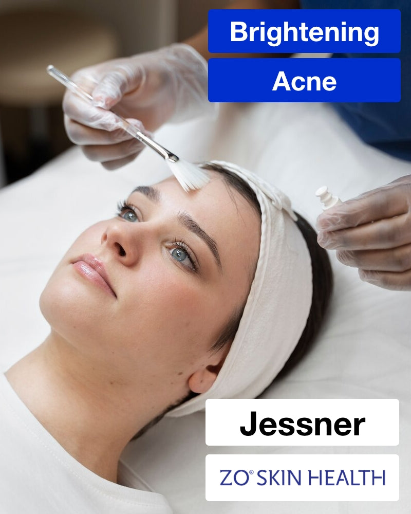 Service Voucher - ZO® Stimulator or Jessner Chemical Peel