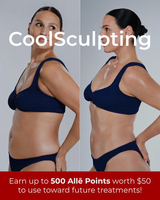 CoolSculpting - Any Area up to total 12 Applicators