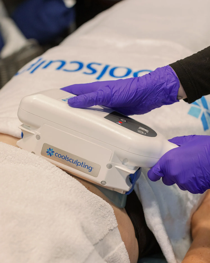 CoolSculpting - Any Area up to total 12 Applicators
