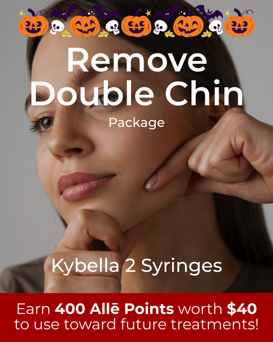 Service Voucher - Get The Chin You’ve Always Wanted Package: 2 syringes of Kybella