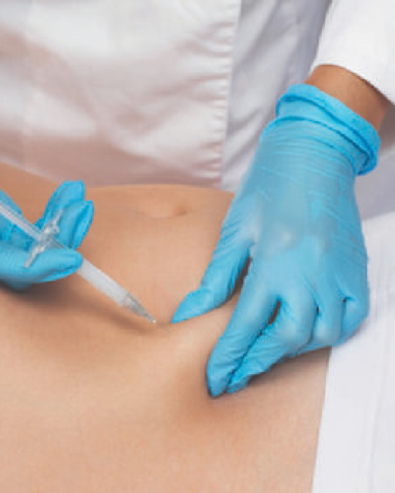 Service Voucher - 12 Fat Burner Shots