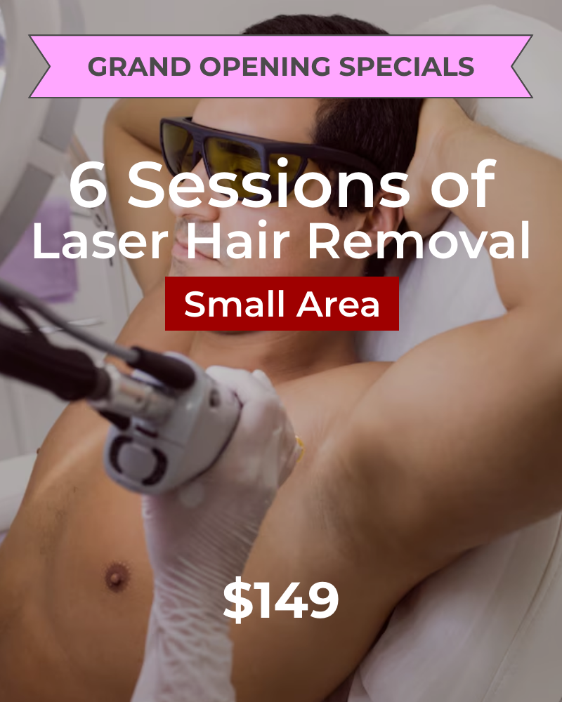 Service Voucher - Six (6) Laser Hair Removal Treatments for Small Area