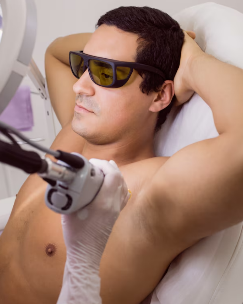 Service Voucher - Six (6) Laser Hair Removal Treatments for Small Area