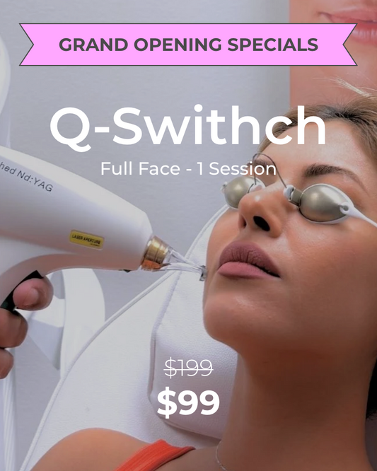 One (1) Q-Switch Laser Facial Full Face Treatment