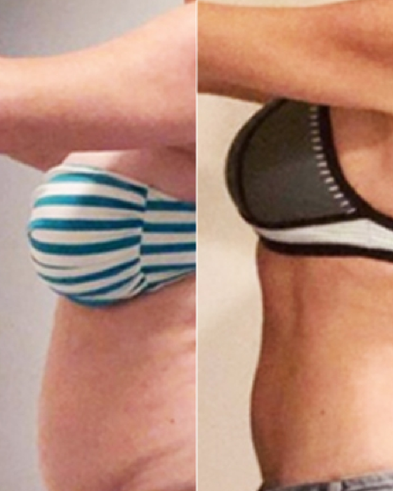 Service Voucher - Semaglutide/GLP-1, 3-month Weight Loss Program + 3 FREE Fat Burner Shots