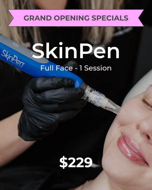 SkinPen – Full Face, One (1) Session