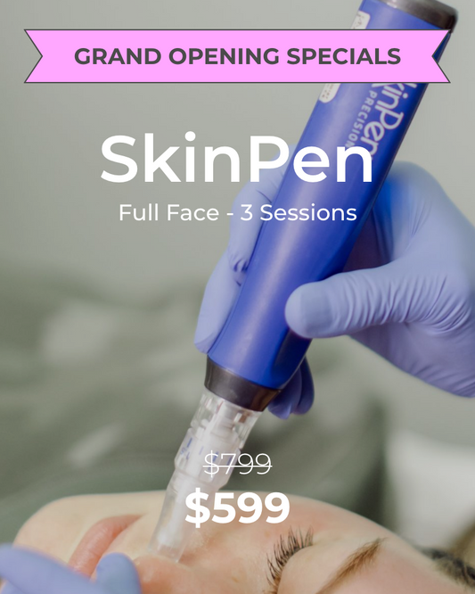 SkinPen – Full Face, Three (3) Sessions