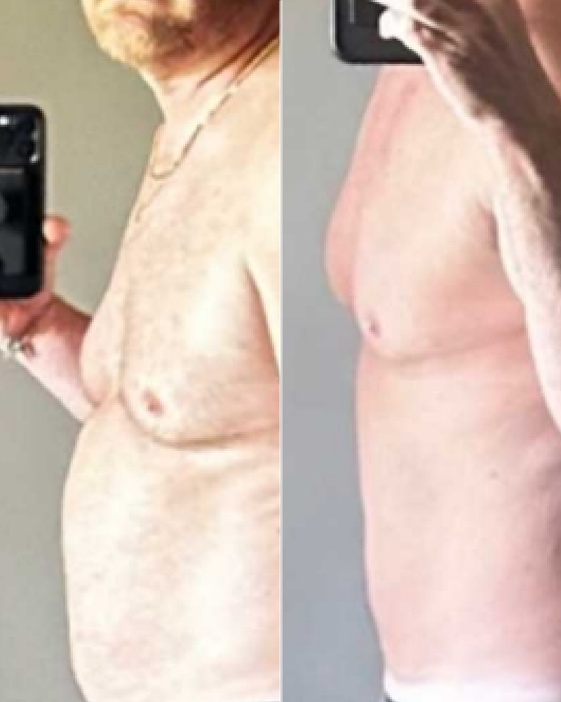 Service Voucher - Tirzepatide GLP-1, GIP 8-Week Program + 3 FREE Fat Burner Shots