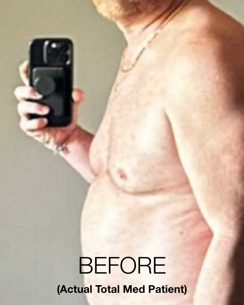 Service Voucher - Tirzepatide GLP-1, GIP 8-Week Program + 3 FREE Fat Burner Shots