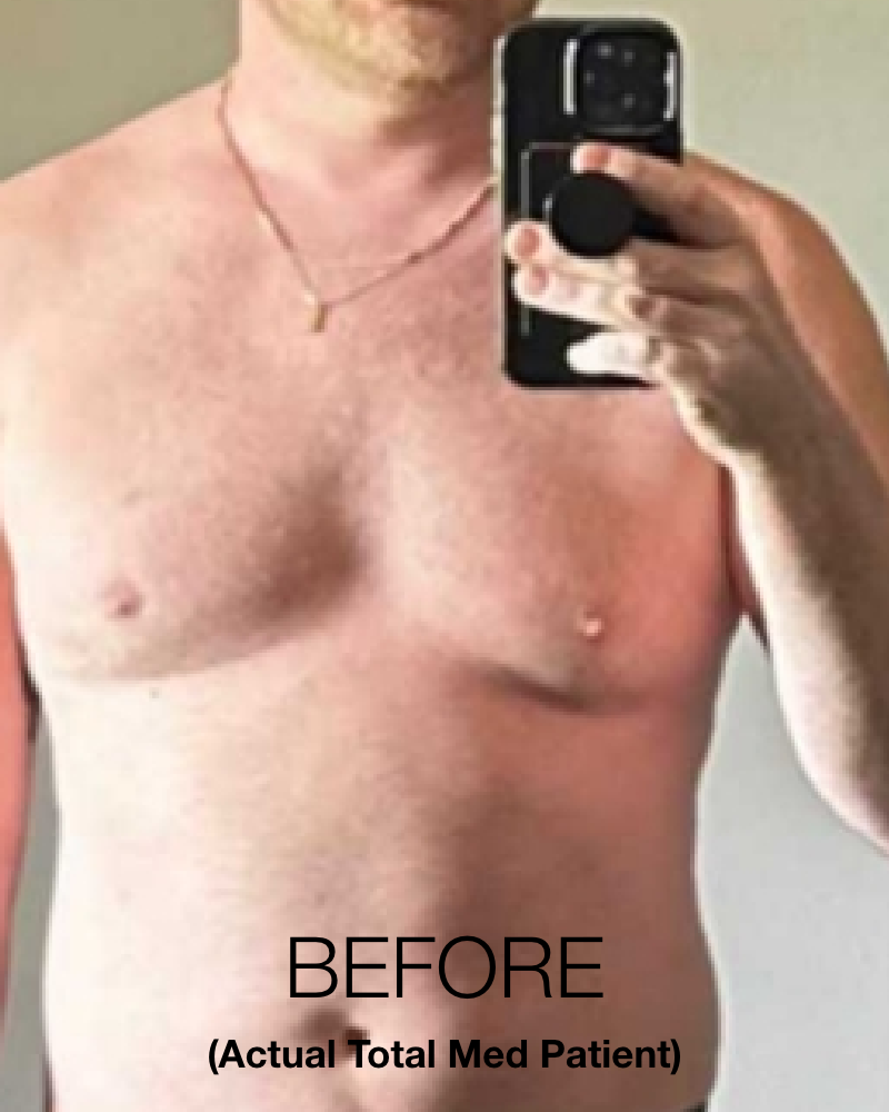 Service Voucher - Tirzepatide GLP-1, GIP 8-Week Program + 3 FREE Fat Burner Shots