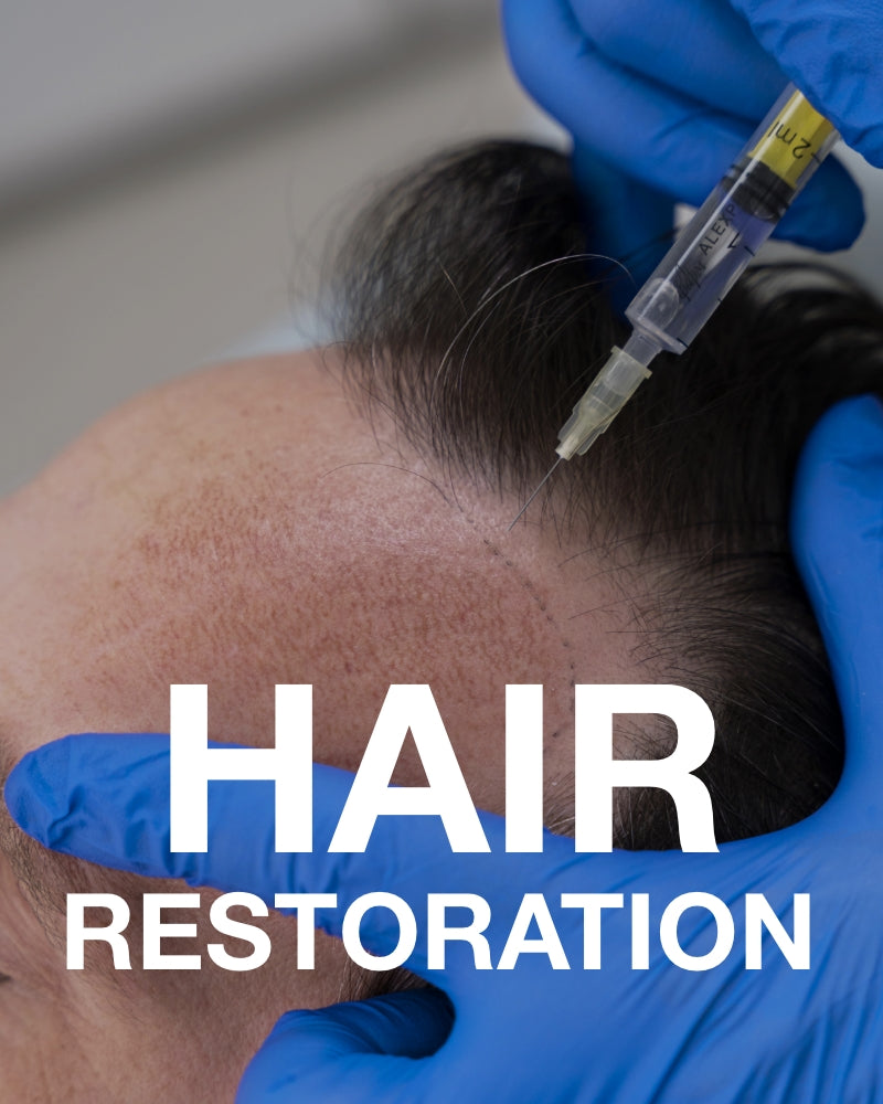Service Voucher - 3 PRP Hair Restoration Treatments