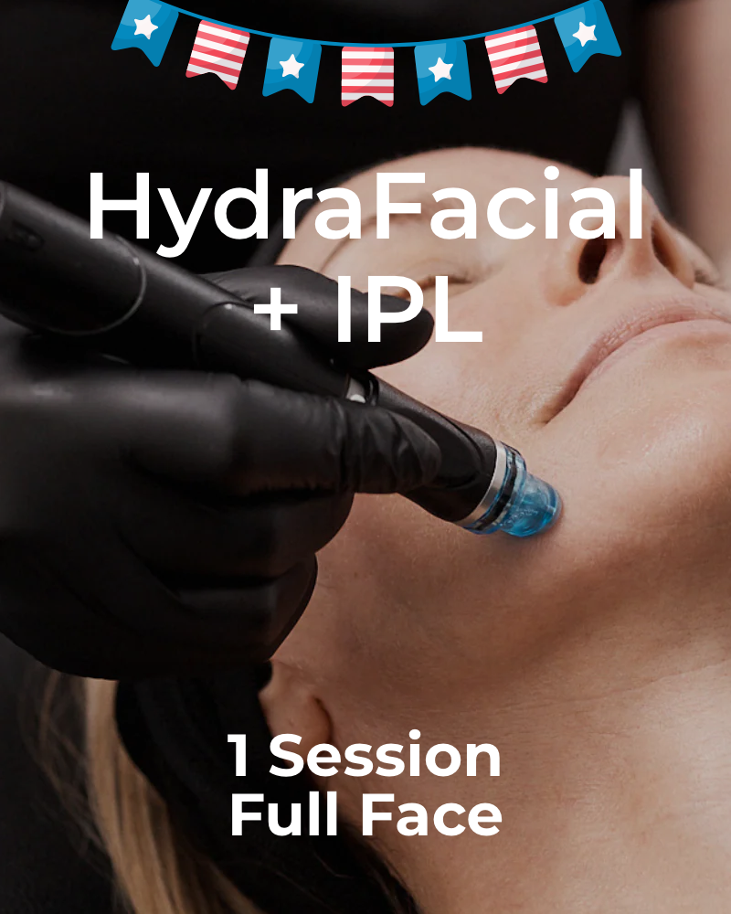 One (1) Signature HydraFacial with IPL - Full Face