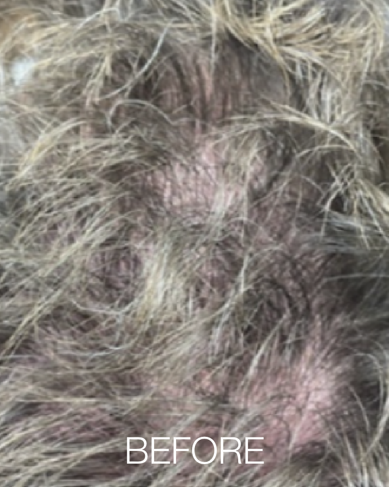 Three (3) Treatments of HydraScalp - Full Scalp + Get FREE HydraFacial Keravive Peptide Complex Spray ($95 Value)