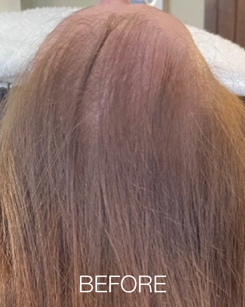 One (1) Treatment of HydraScalp - Full Scalp + Get FREE HydraFacial Keravive Peptide Complex Spray ($95 Value)