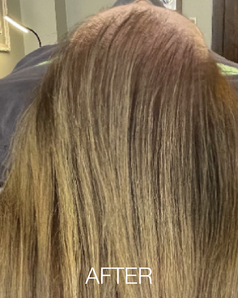 One (1) Treatment of HydraScalp - Full Scalp + Get FREE HydraFacial Keravive Peptide Complex Spray ($95 Value)
