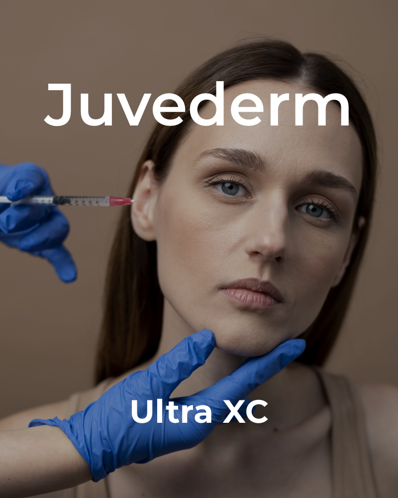 Service Voucher - Juvederm Ultra XC - 1ml Syringe