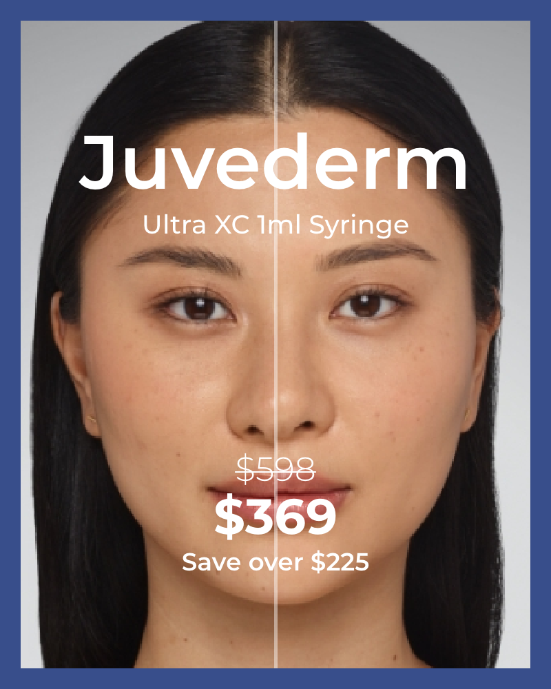 Service Voucher - Juvederm Ultra XC - 1ml Syringe