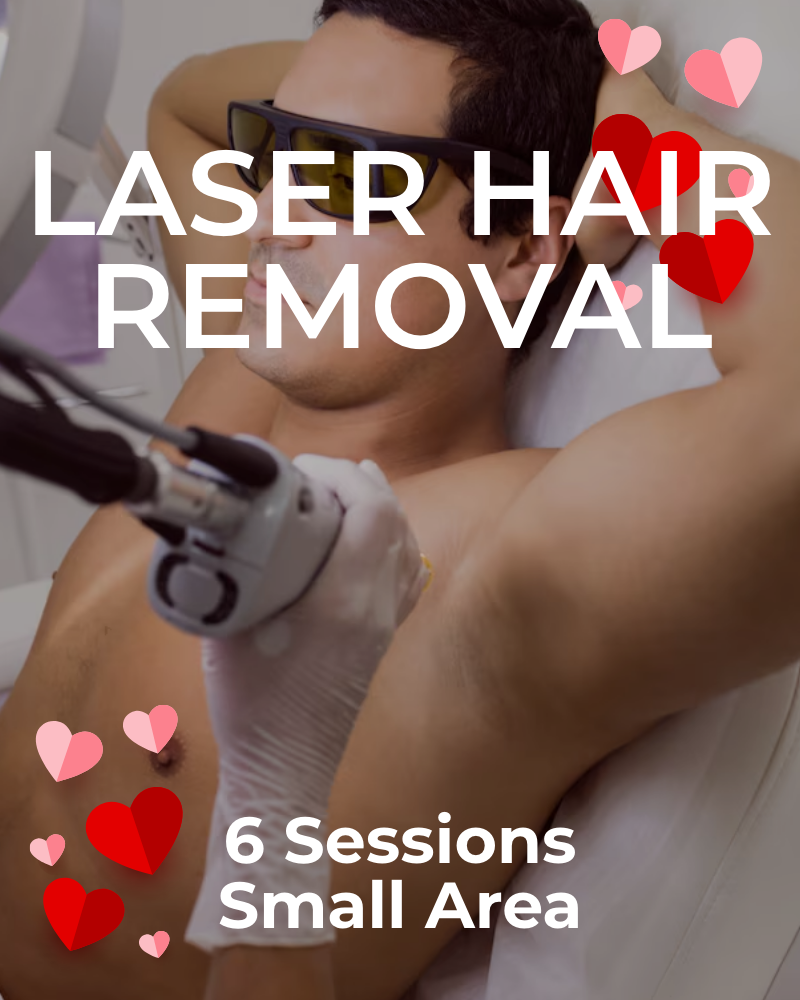 Six (6) Laser Hair Removal Treatments for Small Area