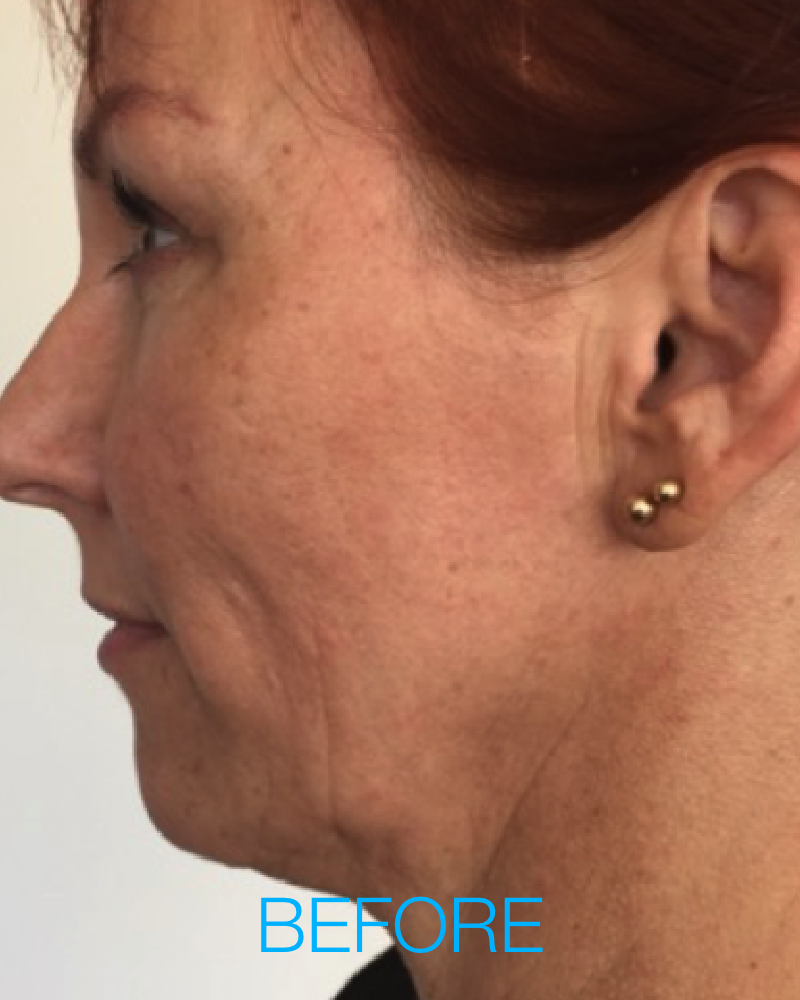 25% OFF PDO Threads with $100 Deposit