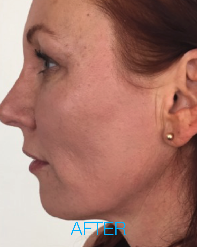 25% OFF PDO Threads with $100 Deposit