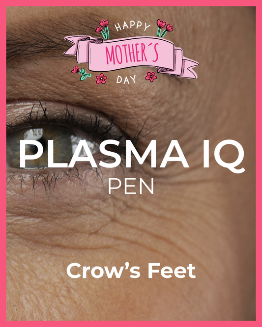 One (1) Plasma IQ Pen Treatment - Crow’s Feet