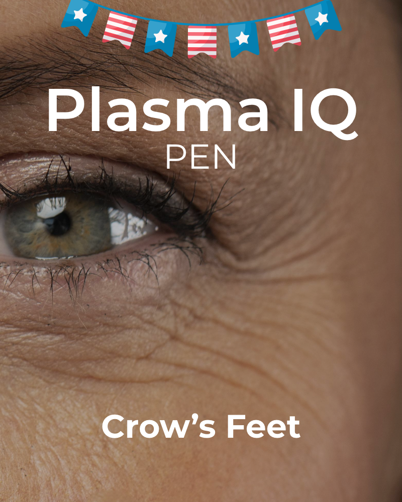 One (1) Plasma IQ Pen Treatment - Crow’s Feet