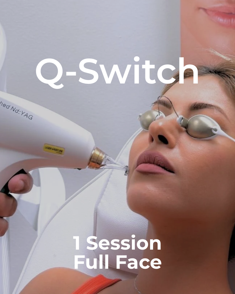 One (1) Q-Switch Laser Facial Treatment - Full Face