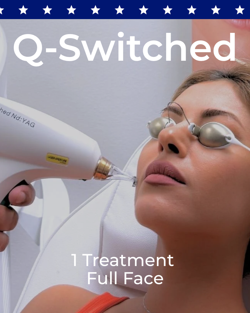 One (1) Q-Switched Laser Facial Treatment - Full Face