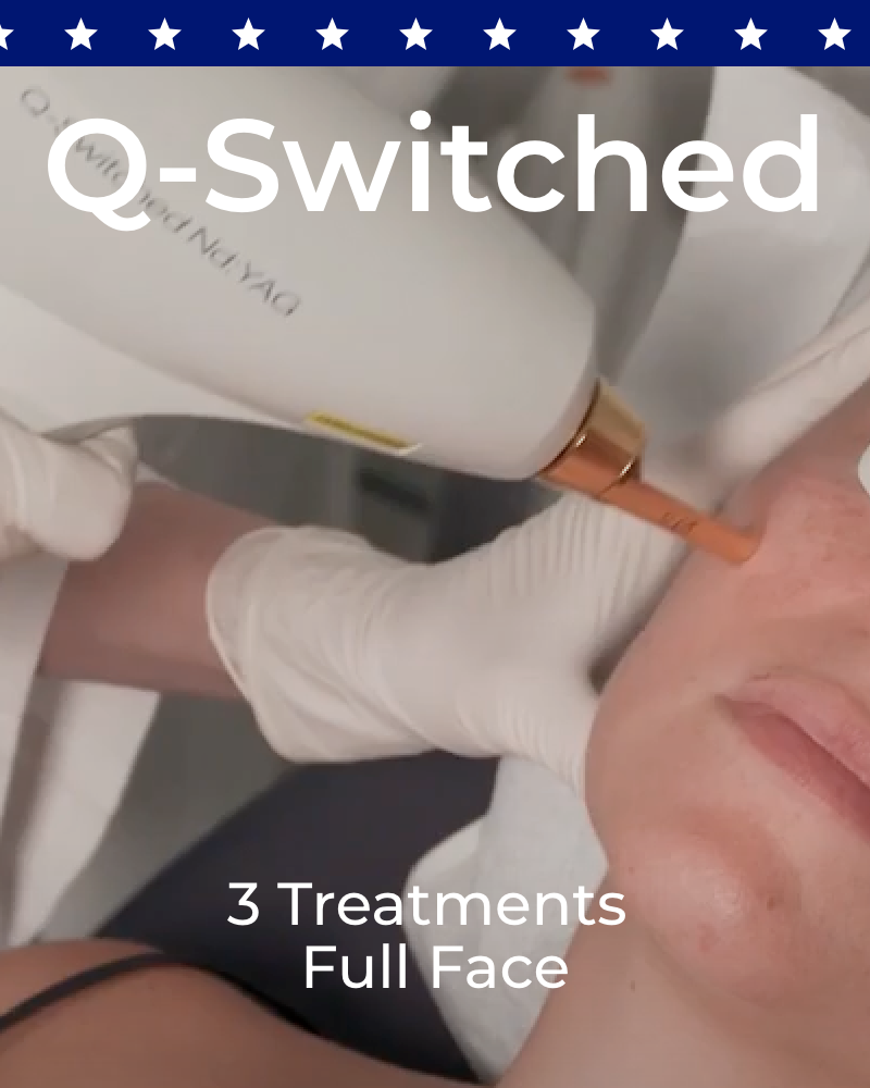 Three (3) Q-Switched Laser Facial Treatments - Full Face