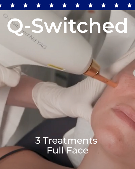 Three (3) Q-Switched Laser Facial Treatments - Full Face