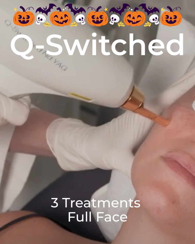 Three (3) Q-Switched Laser Facial Treatments - Full Face