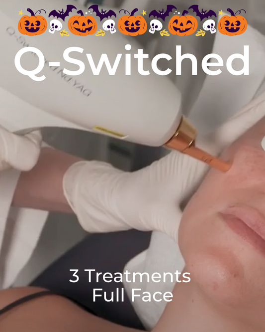 Three (3) Q-Switched Laser Facial Treatments - Full Face