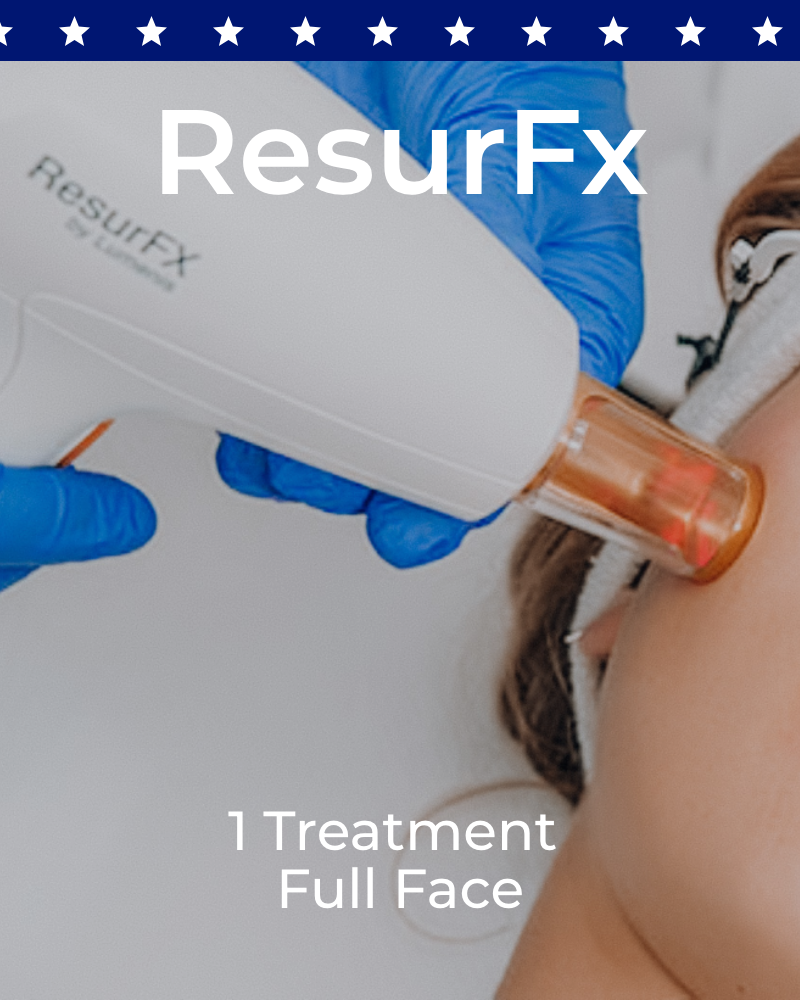 One (1) ResurFX Treatment - Full Face