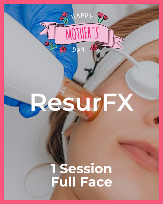 One (1) ResurFX Treatment - Full Face