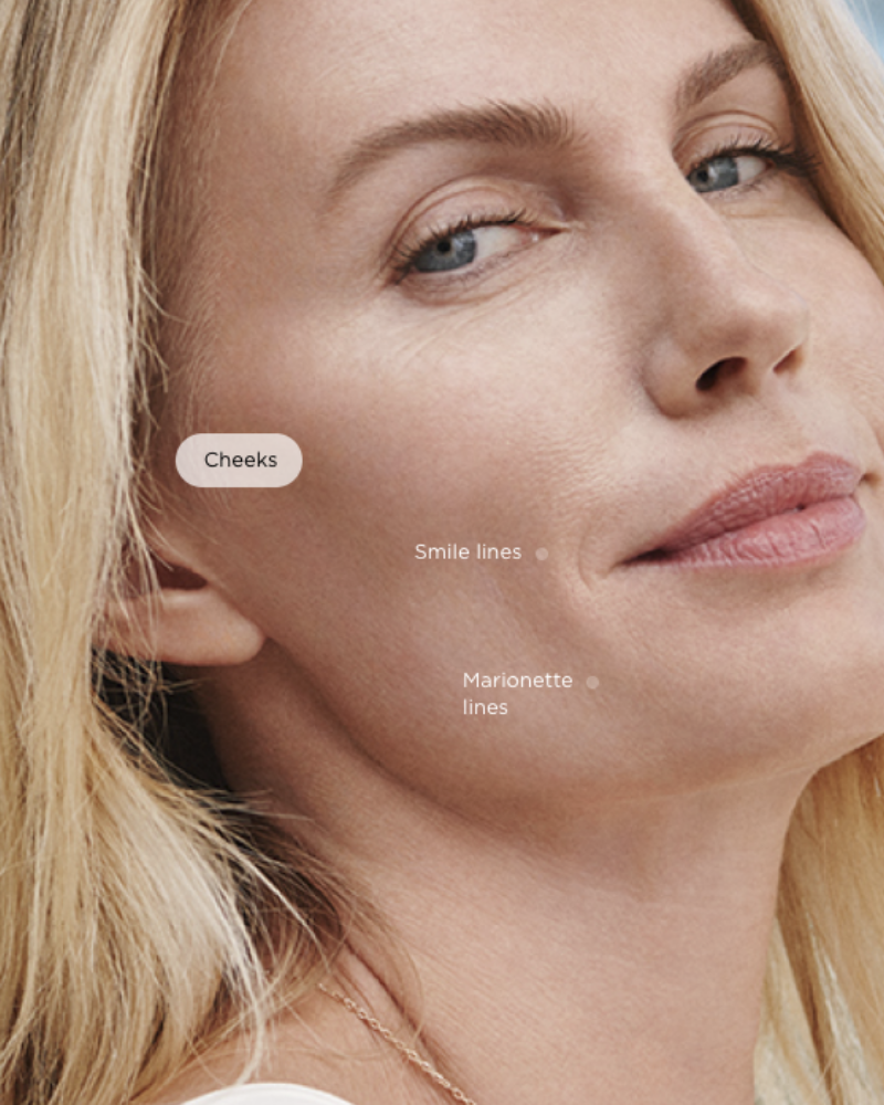 Service Voucher - 2 Vials of Sculptra + One (1) Free Full Face HydraFacial Treatment