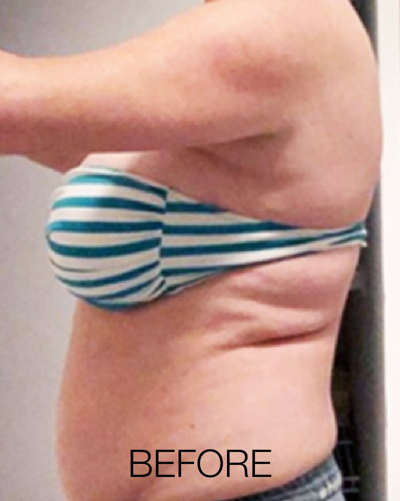 Service Voucher - Semaglutide/GLP-1, 3-month Weight Loss Program + FREE $50 Total Med Gift Card